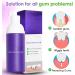 Lot de 3 boosters de blanchiment des dents mousse mousse ultra-fine 50 ml - Buy Online on GoSupps.com