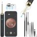 Ear Wax Removal - NIUQICT Ear Cleaner - Ear Camera 1080P with Lights - Ear Wax Removal Tool 9 Pcs - Ear Cleaning Kit Wireless Otoscope Compatible with Android&iOS for Kids Adults&Pets Golden Black