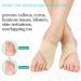 Nofaner Bunion Corrector & Toe Separator for Women - Pinky Toe Straightener with Anti-Slip Strap & Gel Cushion - Toe Pain Relief & Straightening (1 Pair) - Buy Online on GoSupps.com