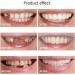 Buy XZLZMD Pebble Gel Dental Prostheses - Natural Color Temporary Veneers for Cracked or Missing Teeth - Fast International Shipping - Buy Online on GoSupps.com