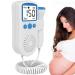 Jolizone Doppler Fetal Heart Rate Monitor Baby Heartbeat Monitor Pregnancy Home Baby Heartbeat Monitor Pregnancy