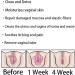 Anniecare Natural Vaginal Capsules & Gel for Repair, Anti-Itch, Slimming & Detox - 1 Bag - Buy Online on GoSupps.com