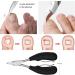 Nail Clipper for Thick Nails Toe Nail Clippers Nail Correction Thick Nails Ingrown Toenails Nippers Cutters Dead Skin Dirt Remover Pedicure Care Tool (Color : Black) - Buy Online on GoSupps.com