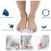 14-Part Silicone Toe Separator & Caps Set | Comfortable Protection for Blisters & Corns | Ideal for Hiking & Daily Use - Buy Online on GoSupps.com