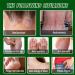 Skin Cleansing Balm Dermatological Body Cleansing Balm for Dry Sensitive and Eczema-Prone Skin - Buy Online on GoSupps.com