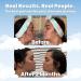 Clean Skin Club Clean Towels: World's 1st Acne-Fighting Biodegradable Face Towel, Dermatology Tested, Super Soft for Sensitive Skin - 25 Count Pack - Buy Online on GoSupps.com
