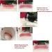 CHNLML Upper and Lower Veneer Dentures - Fake Teeth Natural Shade for Women and Men - Top and Bottom Veneers for Cosmetic Teeth - Protect Your Teeth - Buy Online on GoSupps.com