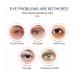 Veze Firming Eye Gel for Women & Men - 5PCS Set | Reduces Puffiness & Dark Circles | Peptide Lifting Eye Cream - Buy Online on GoSupps.com
