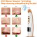2023 Blackhead Remover Pore Vacuum - Upgraded Electric Facial Cleaner for Acne, Whiteheads - 5 Suction Power, 5 Probes - USB Rechargeable Kit for Women & Men - Buy Online on GoSupps.com