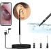 Evonature Earwax Removal Endoscope - 1080P FHD Otoscope Camera with 6 LED Lights, USB Connection - Ear Protection Tool for Android - Safe for Kids, Adults & Pets (Black) - Buy Online on GoSupps.com