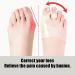 Natudeco Orthopedic Bunion Corrector - Silicone Bunion Support Brace for Pain Relief and Alignment - Buy Online on GoSupps.com