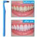 NITAIUN 5-Piece Teeth Stain Remover & Whitening Kit - Oral Hygiene Care Tool - Buy Online on GoSupps.com