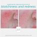 NEOSTRATA Redness Skin Neutralizing Serum | Soothing & Hydrating Face Concentrate | Oil-Free & Fragrance-Free | 29g - International Shipping Available - Buy Online on GoSupps.com