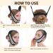Buy Graphene V-Line Mask & Chin Strap for Women - Sleep Support & Jaw Exerciser | Shop Internationally - Buy Online on GoSupps.com