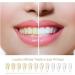 ST4U Teeth Whitening Pen - 1 Pcs Tooth Whitening Gel & Stain Remover for Oral Hygiene - Buy Online on GoSupps.com