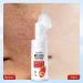 Strawberry Foaming Face Cleanse r with Brush Sensitive Clearing Face Wash Prevents Spots Unclogs Pores and Removes Dirt and Impurities - Buy Online on GoSupps.com