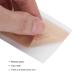 Baby Auricle Valgus Correction Patch - Ear Aesthetic Corrector 4cm*100cm - Buy Online on GoSupps.com