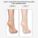 Layhou Foot File Foot Scrubber Callus Remover for Feet Foot Rasp foot file and Callus remover(Metal Foot File) - Buy Online on GoSupps.com