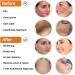 FUSCOTO Skinenjoy Cleansing Lotion for Acne & Spots - Acanthosis Nigricans Therapy Cream Set - Buy Online on GoSupps.com
