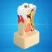 Hilitand 1pc Tooth Model for Dental Comprehensive Pathological Disease Caries Study Teaching Tooth Model - Buy Online on GoSupps.com