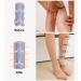 Buy 2 Pairs Medical Compression Stockings 20-30 mmHg for Men & Women Class 2 Closed Toe Support for Varicose Veins & Edema XL 2X Beige International Shipping - Buy Online on GoSupps.com