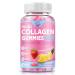 Multi Collagen Peptides Gummies Type I II III V X - Hydrolyzed Collagen Peptides with Biotin Hyaluronic Acid Supports Healthy Skin Strong Nails & Thick Hair 60 Count 1 Pack Strawberry 60 Count (Pack of 1)