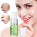 Mole Removal Cream Pigment Repair Gel Melanin Spot Corrector Cream Crea for Skin Brightening & Pigment Removal Dark Spot Recovery Solution - Buy Online on GoSupps.com