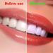 Realistic Upper and Lower Veneer Cosmetic Teeth Set for Confident Smile - 4 PCS Fake Teeth for Men and Women with Comfortable Fit - Buy Online on GoSupps.com