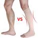 Famkit 23-32mmHg Open Toe Compression Socks for Varicose Veins - Large - Nylon + Spandex - International Shipping Available - Buy Online on GoSupps.com