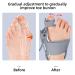 Bunion Corrector with Toe Spacers - Adjustable Big Toe Straightener for Effective Bunion Relief | Best Toe Separators for Women - Buy Online on GoSupps.com