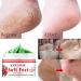 Frost Protection Cream for Feet | Anti-Crack Moisturizer & Dead Skin Foot Butter | Nourish & Repair with Effective Foot Care Cream - Buy Online on GoSupps.com