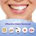 Ualans Teeth Whitening Kit Refill - 4PC Professional Tooth Bleaching Gel for Safe & Effective Whitening | Brightening & Soothing Gel Included - Buy Online on GoSupps.com