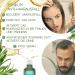 170 ml - Applicateur de racine compatible avec le lotion capillaire WELEDA l'huile de romarin - Pr vient la chute des cheveux et favorise la croissance des cheveux (Vegan) 2x100 ml 100 ml (Lot de 2) 200 - Buy Online on GoSupps.com