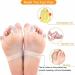 Gel Bunion Pads & Toe Separators - Effective Bunion Relief Correctors for Day & Night Support - Buy Online on GoSupps.com