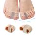 Toe Distance Holder Breathable Gel Bunion Corrector for Pain Relief & Overlapping Toes | UWK113 - Buy Online on GoSupps.com
