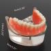 Gljy Dental Restoration Model - Overdenture Inferior 2 Implants Teaching Aid | Detachable Dental Teeth Model for Precision Demo | International Shipping Available - Buy Online on GoSupps.com
