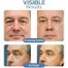 Peptide Eye Gels Set Awaken Peptide Lifting Eye Gel Rejuvenating Eye Lifting Gel for Men and Women Anti-Aging Eye Serum for Men Men's Anti-Aging Serum for Firming(2 set) - Buy Online on GoSupps.com