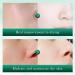 Shantou Youjia Centella Serum Hydrating serum for womens skin care Intensive moisturizing care for smooth and delicate skin Niacinamid Whitening serum 100g jixuecaoessence 1 g 1er Pack - Buy Online on GoSupps.com