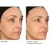 NassifMD Pro Peptide Collagen Serum | Anti-Aging Treatment for Fine Lines Wrinkles & Textured Skin - Firm & Smooth Your Skin - Buy Online on GoSupps.com