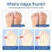 Heasoy Bunion Corrector - Gel Cushion Pads for Hallux Valgus Relief - Toe Straightener for Men & Women (2 Pairs) - Buy Online on GoSupps.com