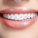 Yiurse Toothstones Reflective Crystal Set - DIY Dental Jewelry & Tartar Remover - Fashionable Professional Teeth Care - Buy Online on GoSupps.com