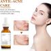 Retinol Serum for Face Retinol 1% in Squalane Reduce the Appearances of fine Lines of Photo Damage and of General Skin Ageing Acne Reduced Brighten & Smooth Skincare for Women & Men - Buy Online on GoSupps.com