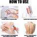 Fast Acting Cream Wart Remover - Maximum Strength Relief for Plantar Genital Common & Flat Warts - International Shipping Available - Buy Online on GoSupps.com