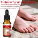 XPEX 30ml Mycose Ongles Des Pieds Strengthens and Revitalizes Nails pour Nails Damaged by Mycosis or Light Trauma pour D color s Endommag s et pais - Buy Online on GoSupps.com