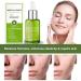 Goopgen Advanced Scar Repair Serum 30ML - Nature Scar Treatment - Scar Removal Serum for All Types of Scars (1PC) - Buy Online on GoSupps.com