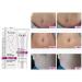 RtopR Mango Stretch Marks & Scar Cream - Pregnancy Safe Removal Moisturizer 40g - 1.41 Ounce - Buy Online on GoSupps.com