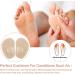 Ball of Foot Cushions - 2 Pairs Anti-Slip Gel Metatarsal Pads for High Heels | Comfort & Support for All-Day Wear - Buy Online on GoSupps.com