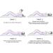 TIST Neck Cloud Cervical Traction Device Neck and Shoulder Relaxer for TMJ Pain Relief and Cervical Spine Alignment - Buy Online on GoSupps.com