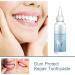 Gel de r paration des gencives gel de r paration des dents protection des gencives et soins bucco-dentaires nettoyage en profondeur des gencives haleine fra che (3) - Buy Online on GoSupps.com