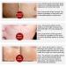 LANBENA Pore Care Serum - Shrinks Pores, Controls Oil, and Hydrates Skin - Buy Online on GoSupps.com